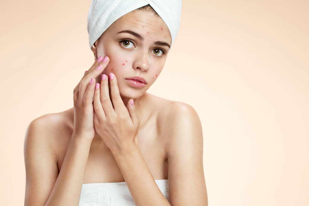 Pimples and Pores Facial