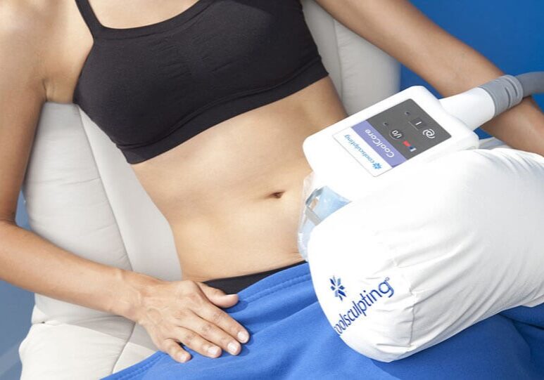 Coolsculpting-for-stomach (1)