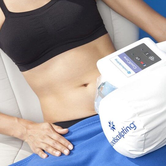 Coolsculpting-for-stomach (1)