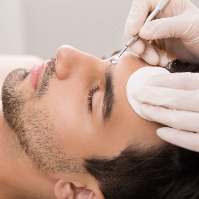 Cosmetician,Using,Blackhead,Remover,For,Cleaning,Man,Face,In,Spa