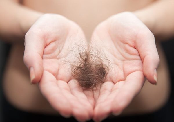 hair loss