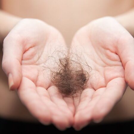 hair loss